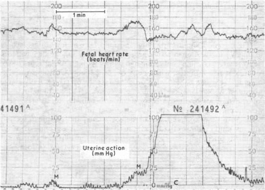 FIG 1