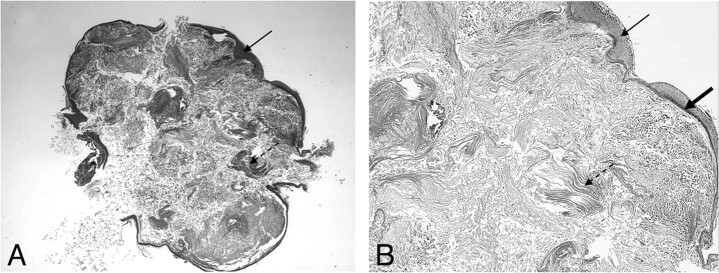 Fig 9.