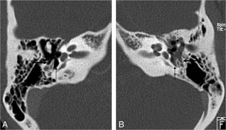 Fig 6.