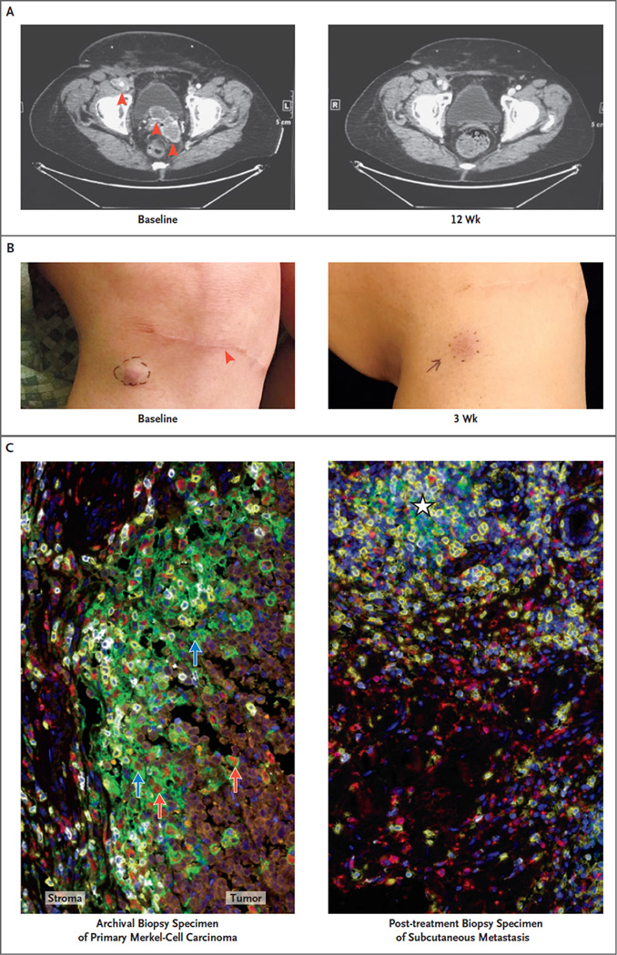 Figure 3 (facing page)