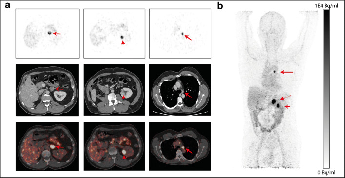 Fig. 2