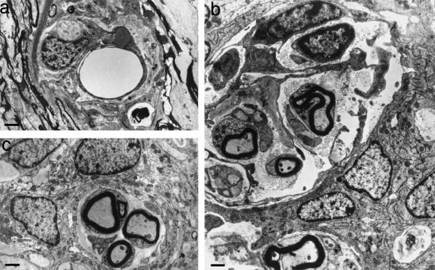 Fig. 13