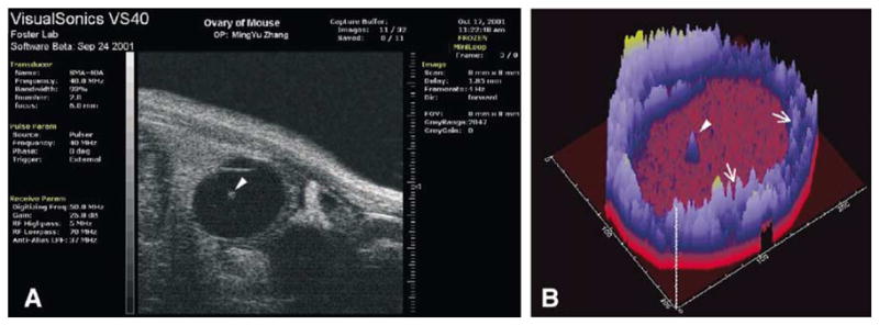 Fig. 11