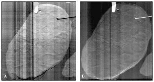 Fig. 13