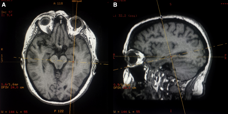 Supplementary Figure 1