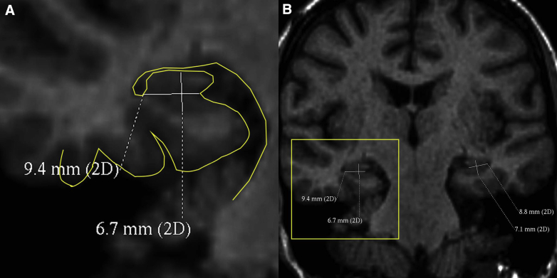 Fig. 1