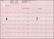 Fig 4.