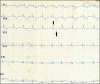 Fig 2.