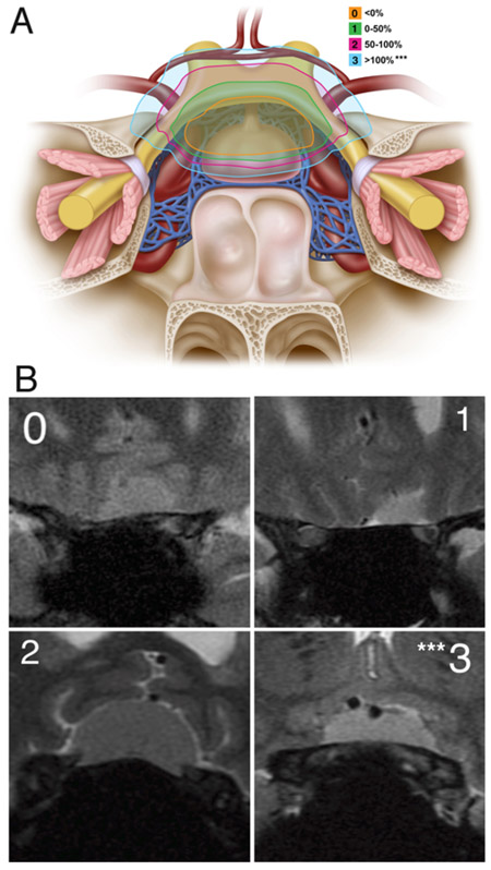 FIG. 1.