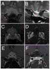 FIG. 5.