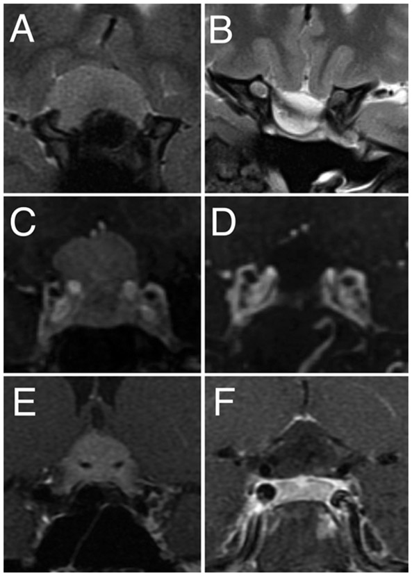 FIG. 5.