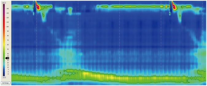 Fig. 1