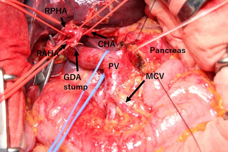 Figure 4: