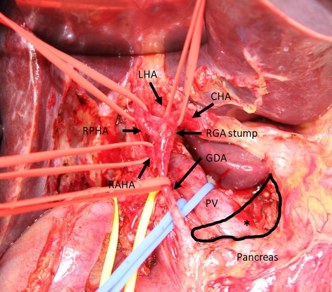Figure 3: