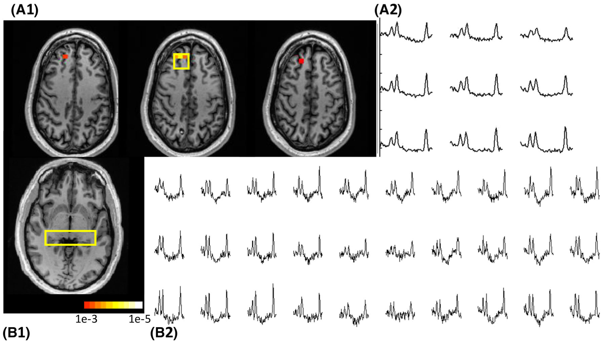 FIGURE 3