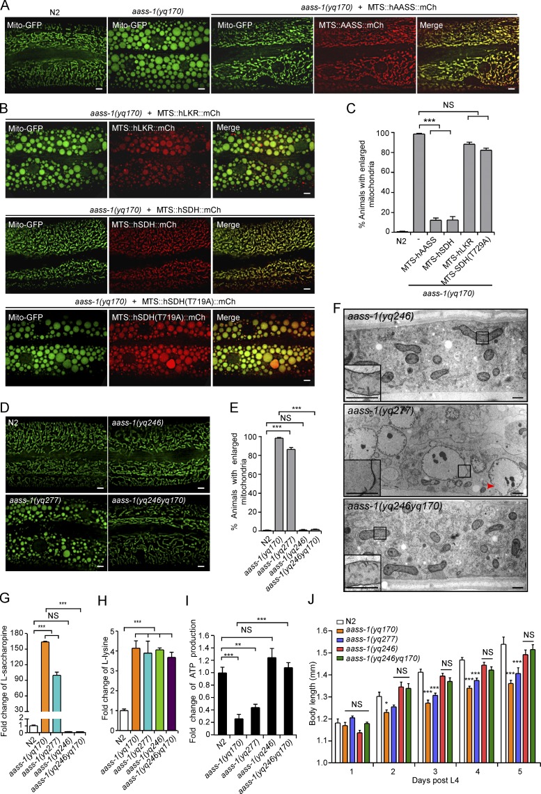 The lysine catabolite saccharopine impairs development by disrupting ...