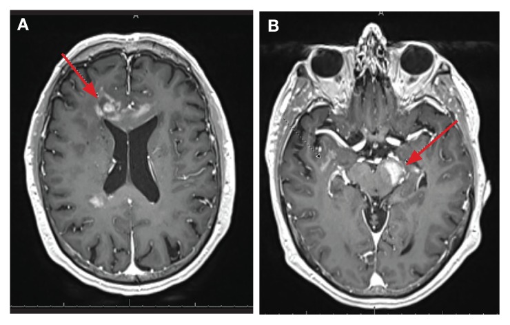 FIGURE 3