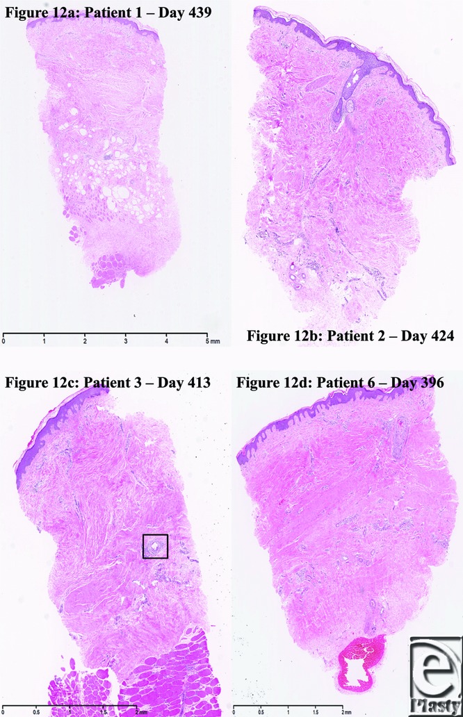 Figure 12