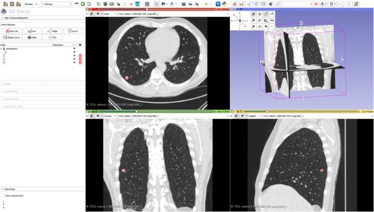 Fig.3