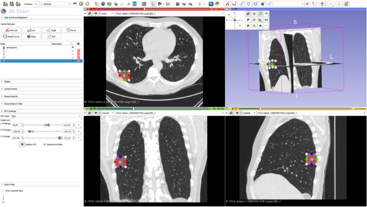 Fig.2