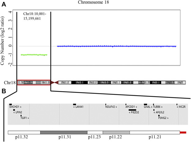 FIGURE 3