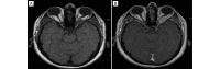 FIG 5.