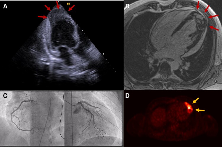 Figure 2