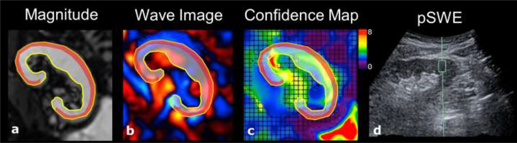 Figure 1: