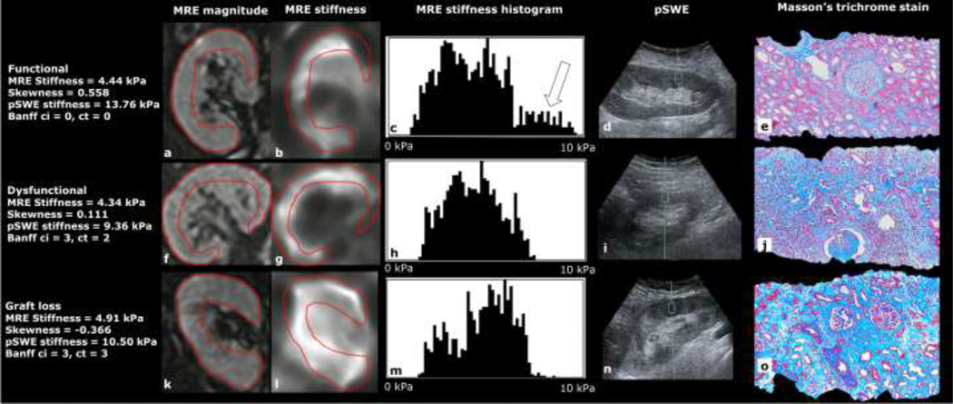 Figure 3: