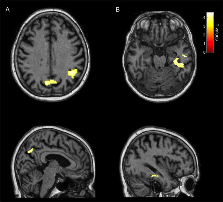 Fig 6