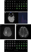 Fig. 3