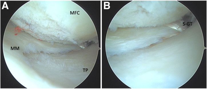 Fig 8