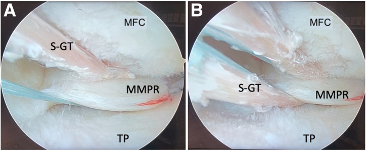 Fig 7