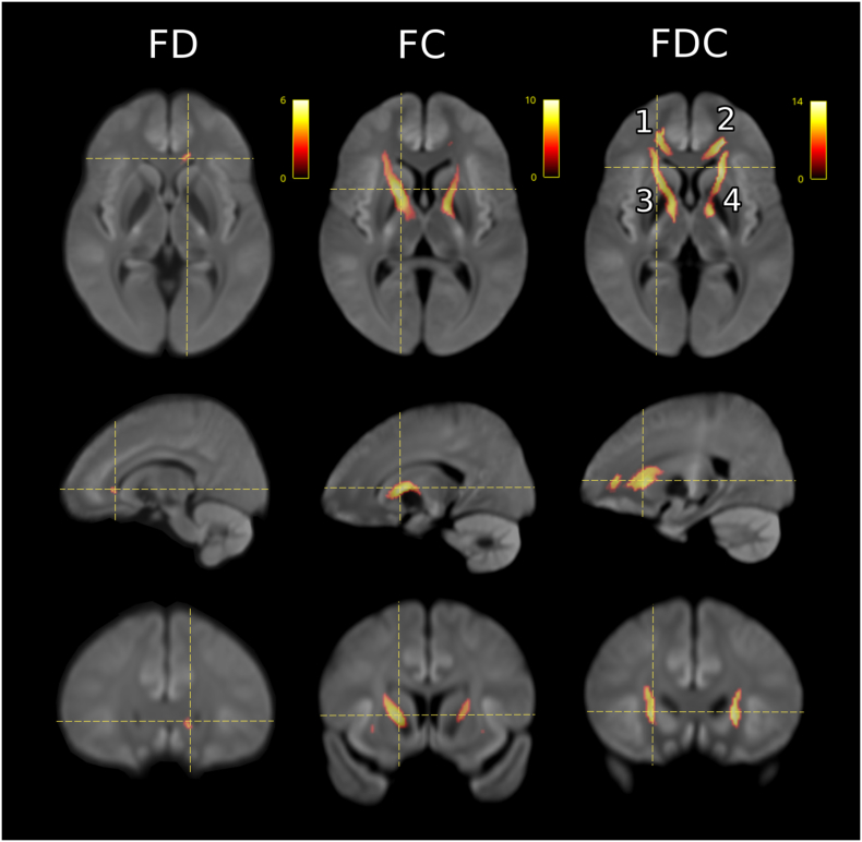 Fig. 2