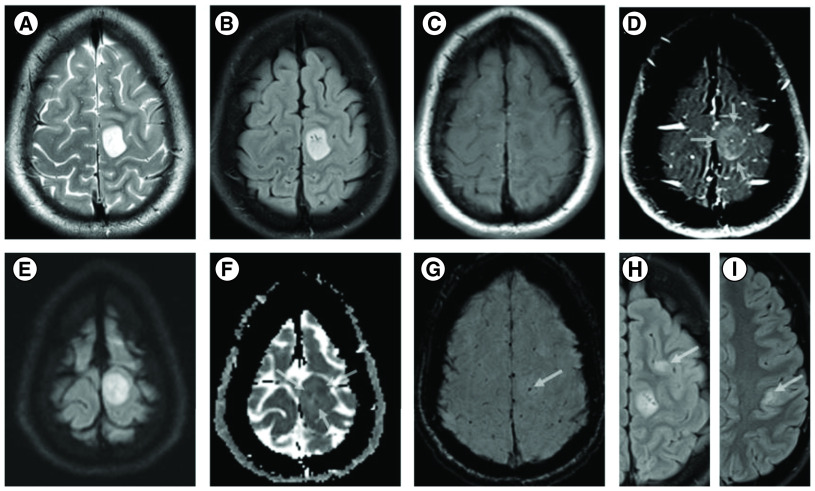 Figure 2. 