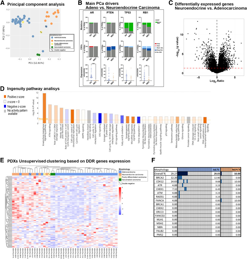 Figure 5. Molecular comparison between largest morphologic groups, Ad and NEPC. A, PCA of RNA-seq data. Scatter plot displays the first two principal components (PC). Each point represents a sample. Samples with similar gene expression profiles are clustered together. Samples are colored on the basis of morphologic groups. B, Percentage distribution of driver mutations or CNVs and expression of AR, PTEN, TP53, and RB1 in Ad and NEC (NEPC). P = 9 × 10−5 for RB1 and P = 4 × 10−9 for AR mRNA expression. C, Volcano plots depicting differential expression of each gene between Ad and NEPC PDX groups. Red dotted line represents a q-value of 0.05 to indicate significance threshold. D, Bar chart showing top 30 most significant “canonical pathways” identified from IPA based on differentially expressed genes (NEPC/Ad). The orange and blue bars indicate predicted pathway activation (z-score ≥ 2) or inhibition (z-score ≤ −2). For gray bars, no activity prediction can currently be made. White bars indicate pathways with z-scores at or very close to 0 or those that are ineligible for analysis because there are fewer than four molecules in the dataset associated with the pathway (z-score = NaN). E, Nonsupervised clustering based on the expression of DDR-associated genes in MDA PCa PDXs. Top column depicts model morphology. F, Genomic status of main DDR genes in Ad and NEPC MDa PCa PDXs. Colored rectangles indicate presence of driver genomic alterations.