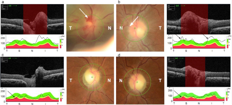 Fig. 3