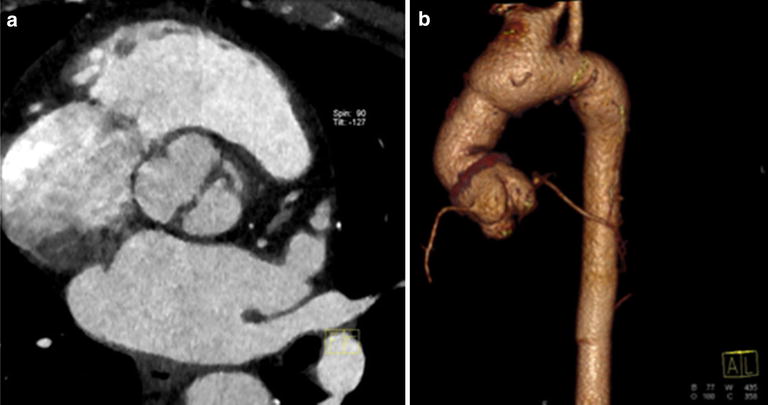 Fig. 6