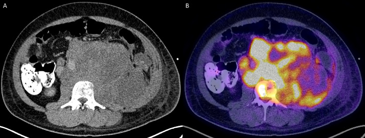 Fig 3 –