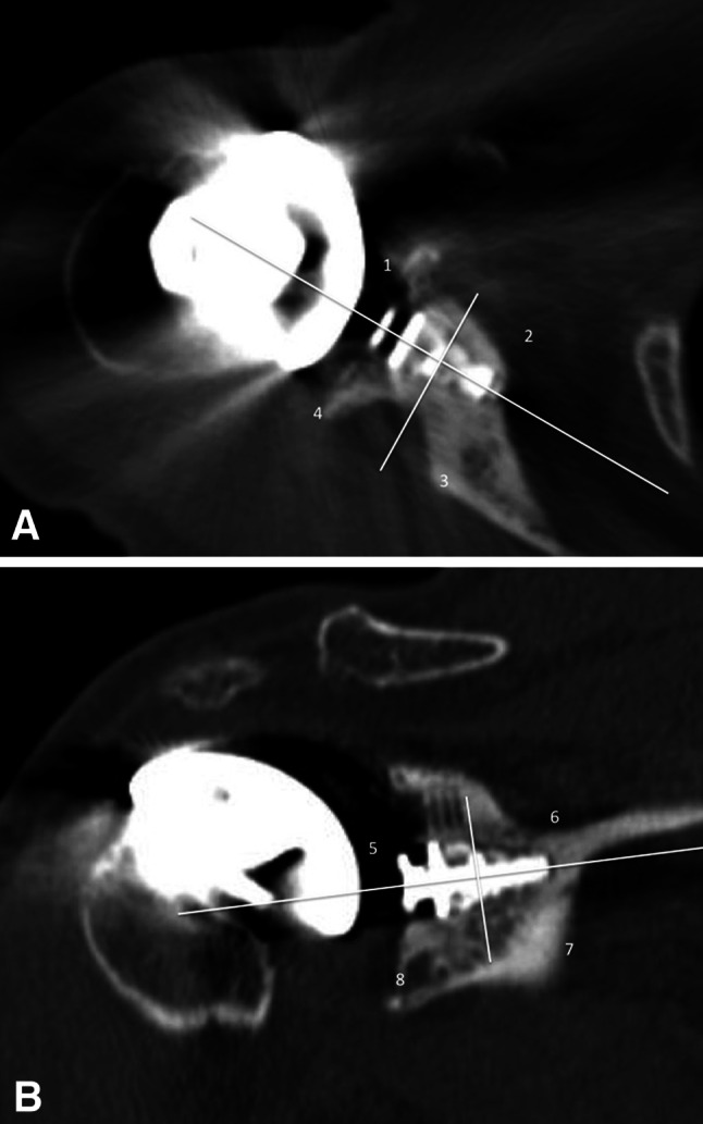 Fig. 2A–B