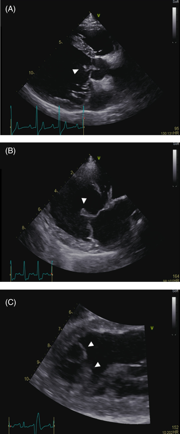 FIGURE 1