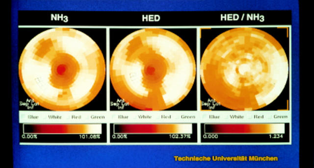 Figure 4  