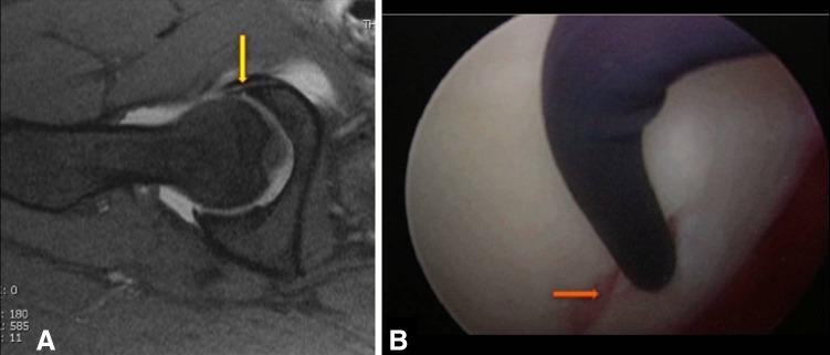 Fig. 1A–B