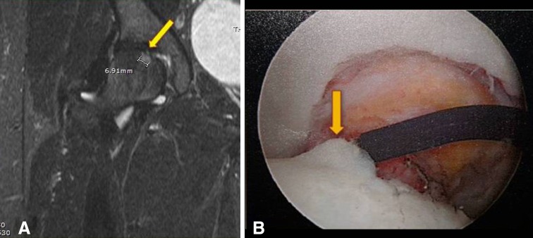 Fig. 2A–B