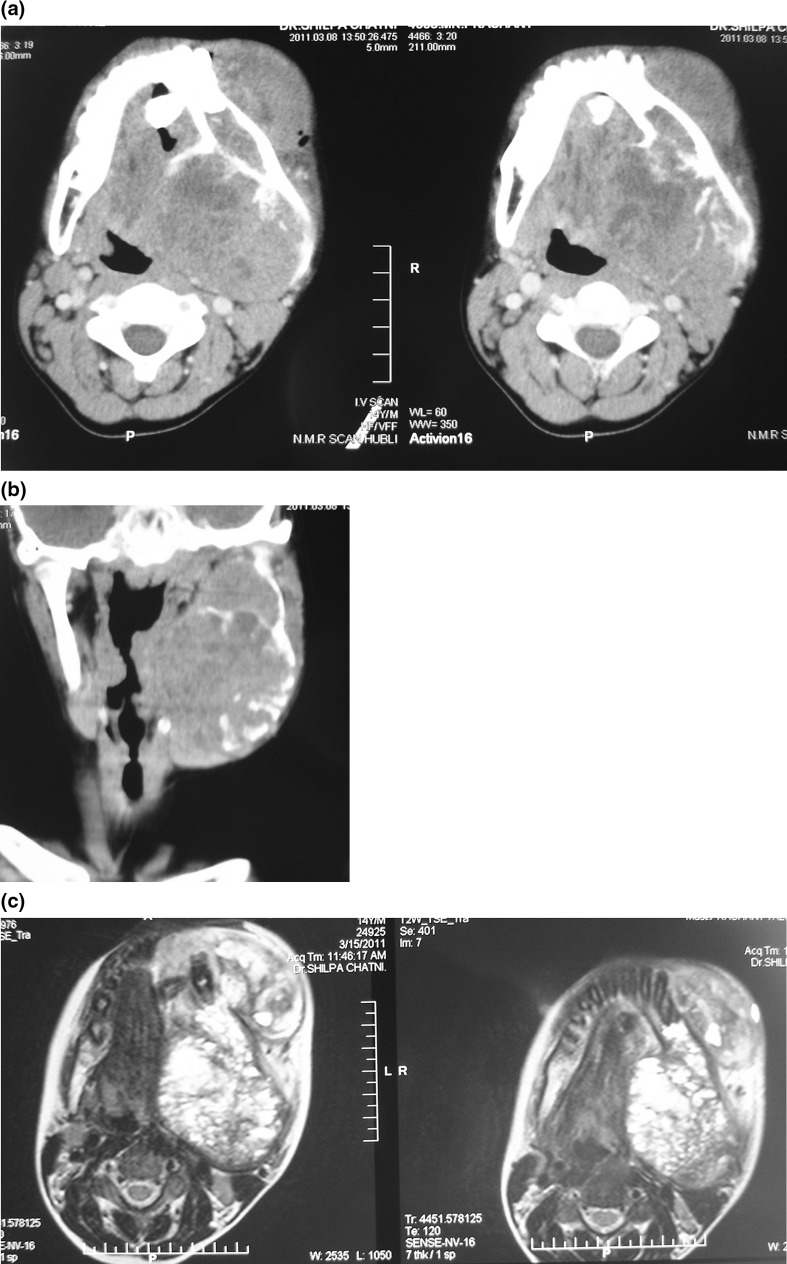 Fig. 3