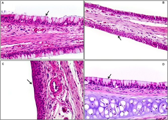 FIGURE 13