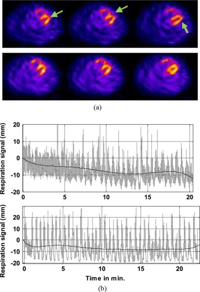 Fig. 14