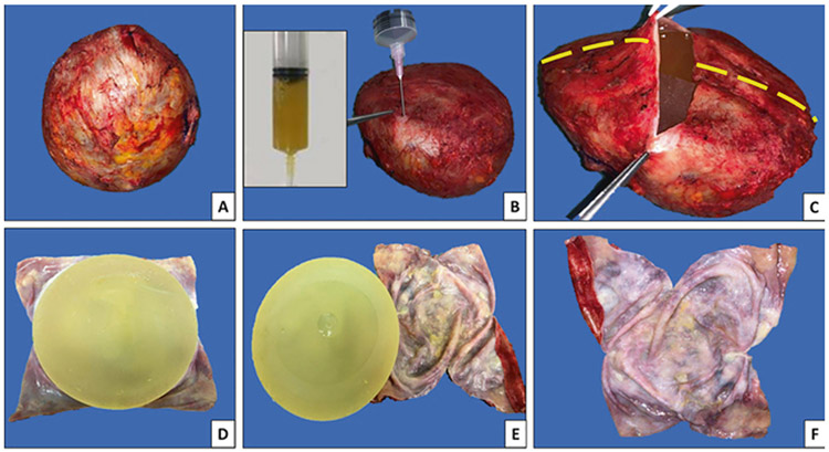 Fig. 4