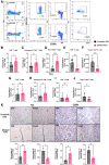 Figure 5. Malat1 inhibition increases T-cell infiltration in the TME. A, Gating strategy used to identify cytotoxic CD8+ T cells and regulatory CD4+ T cells in the TILs of 2208 L tumors using FlowJo 10.8.1. B–J, Flow cytometry quantification of T cells as the percentage of CD45+ populations in 2208 L and T12 tumors using GraphPad Prism 9.4.1. Error bars represent standard deviation (SD), *, P < 0.05; **, P < 0.01; ***, P < 0.001 using the two-tailed unpaired Student t test. Eight tumors were used for each treatment group. The experiment was performed once with T12 primary tumors and twice with 2208 L primary tumors. K, Representative IHC images of tumor sections stained for CD8α and Foxp3; bar, 80 μm. Quantifications of positive area of tumor sections with ImageJ using the geometric mean of up to 3 representative images from each tumor section, with n = 3–4 tumor sections for each experimental group. Error bars represent SD, *, P < 0.05; **, P< 0.01; ***, P < 0.001 using the two-tailed unpaired Student t test.
