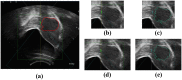 Fig 14